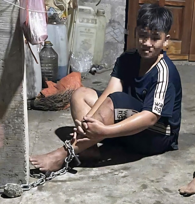 Hình ảnh cháu D. bị xích chân. Ảnh: Gia đình cung cấp.