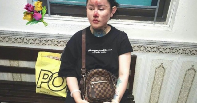 15 phút gây huyên náo phố phường của Ngân "Baby"