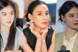 Chuyên gia phân tích nghi vấn can thiệp thẩm mỹ của Trương Bá Chi