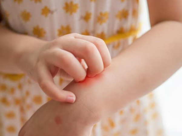 Nhiều người bị nhiễm ký sinh trùng nhưng không có dấu hiệu rõ ràng&nbsp;