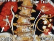 Người phụ nữ được phát hiện có 4 quả thận khi khám đau lưng