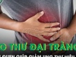 Thay đổi lối sống với 5 thói quen giúp giảm nguy cơ ung thư đại tràng