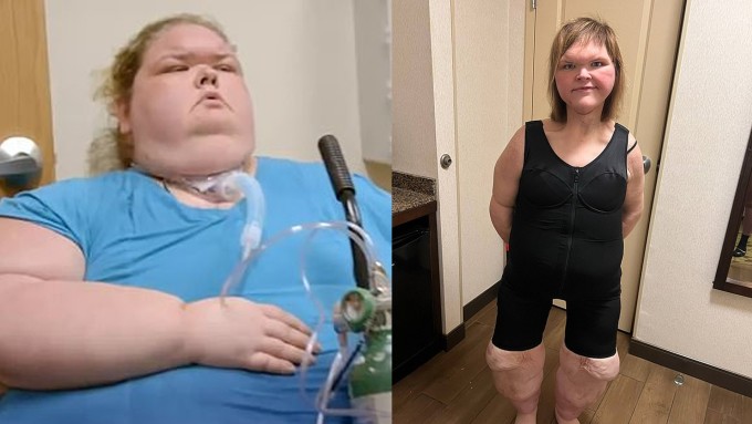 Tammy năm 2022 và hiện tại. Ảnh: Dailymail