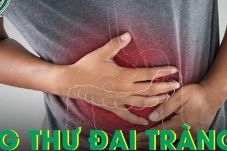 Thay đổi lối sống với 5 thói quen giúp giảm nguy cơ ung thư đại tràng
