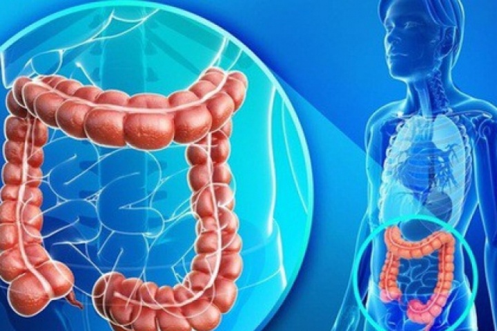 Dấu hiệu nhận biết ung thư trực tràng: Người trong gia đình có dấu hiệu này cần cảnh giác
