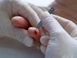 Có nên chích đầu ngón tay khi đột quỵ?