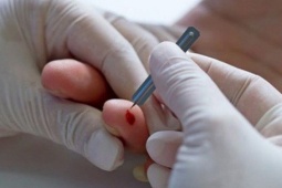 Có nên chích đầu ngón tay khi đột quỵ?
