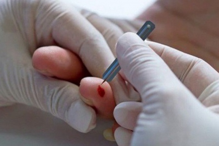 Có nên chích đầu ngón tay khi đột quỵ?