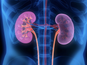 7 triệu chứng ung thư thận dễ bị bỏ qua