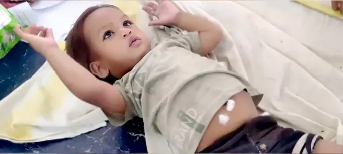 Bé Govind Kumar đang được theo dõi tại bệnh viện sau khi cắn chết rắn hổ mang. Ảnh: India Today