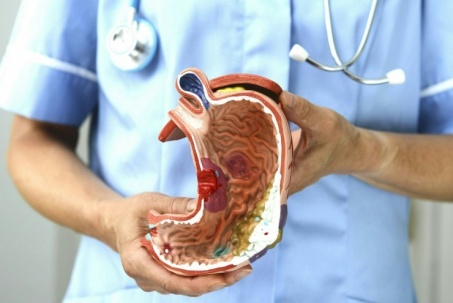 80% ca ung thư dạ dày đến từ một nguyên nhân quen thuộc