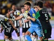 Video bóng đá Ngôi sao K League - Newcastle: Vừa thua mất mặt, vừa tổn thất lực lượng