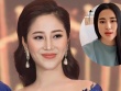 Tố My nhập viện vì phình động mạch não