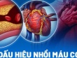 Thu hồi loại gel nano bạc kháng khuẩn, làm sạch da không đạt chất lượng