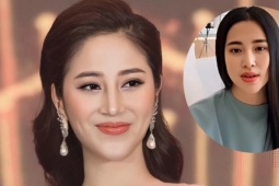 Tố My nhập viện vì phình động mạch não