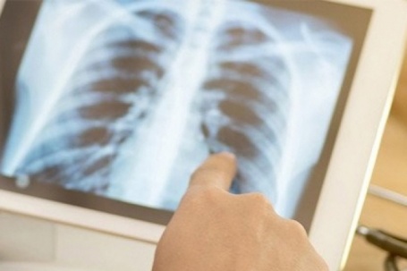 Phát hiện cùng lúc 2 loại ung thư từ triệu chứng khi ăn