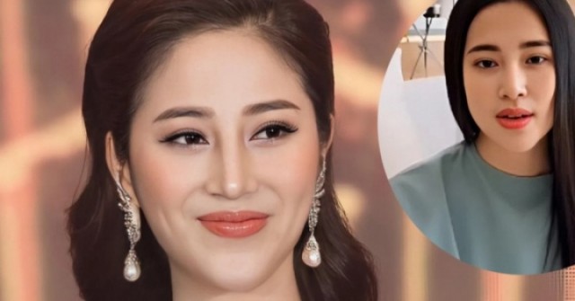 Tố My nhập viện vì phình động mạch não