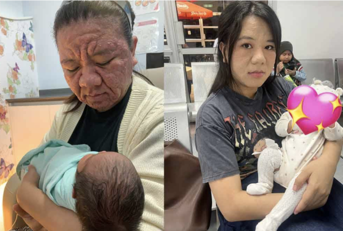 Gương mặt của Farah Faizal khi vừa sinh con (trái) và sau khi sinh hai tháng. Ảnh: Sinardaily