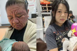 Bất ngờ nổi tiếng với khuôn mặt biến đổi khi mang bầu