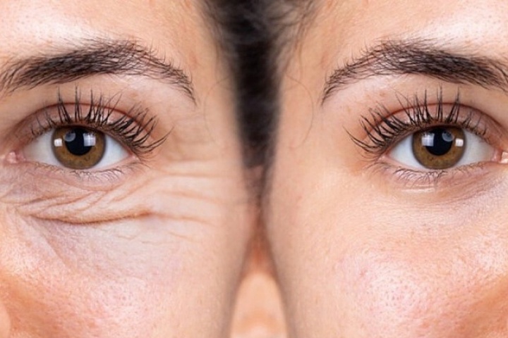 Phân biệt Tretinoin và Retinol: Đâu là lựa chọn phù hợp cho làn da của bạn?