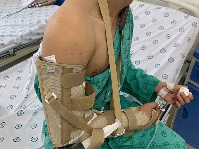 Chơi vật tay với bạn, nam thanh niên phải nhập viện điều trị. Ảnh: Bệnh viện cung cấp