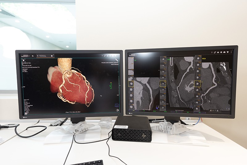 Hình ảnh chụp CT từ Naeotom Alpha được đánh giá sắc nét nhất hiện nay.