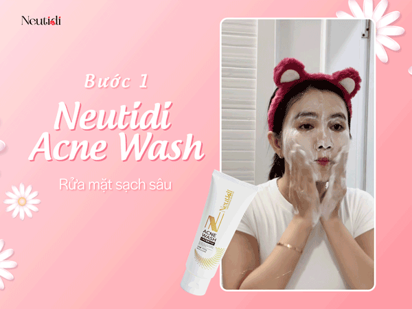 Chăm sóc da mụn kiểu mới cùng Neutidi Nhật Bản với 3 bước đơn giản mà hiệu quả - 2