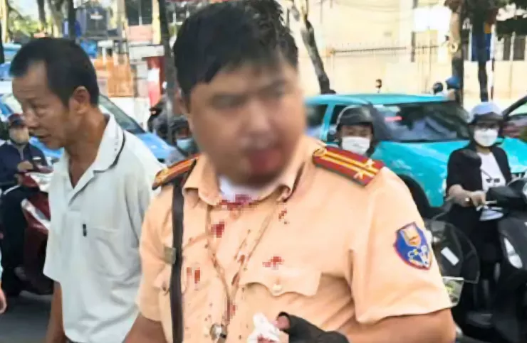 Trung tá Ngô Tùng Giang bị thương sau khi bị Khafizov Artur tấn công. Ảnh: PA Trung tá Ngô Tùng Giang bị thương sau khi bị Khafizov Artur tấn công. Ảnh: PA