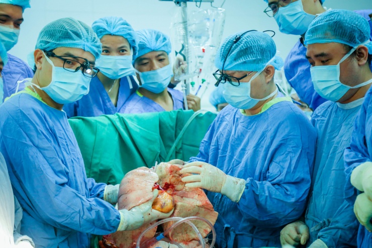 Khối tim - phổi của người hiến được chuẩn bị đưa vào ghép cho bệnh nhân.