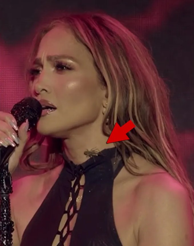 Jeninifer Lopez gặp sự cố côn trùng 'tấn công'.