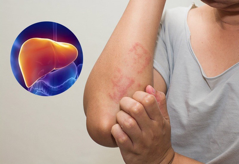 6 thói quen tưởng vô hại "đầu độc" gan mỗi ngày - 2