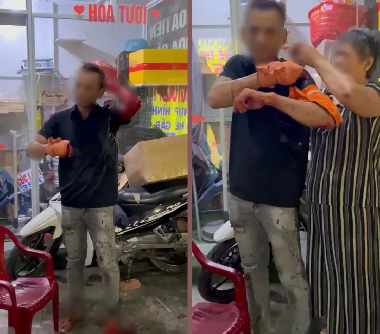 Anh M bị chém trọng thương, được đưa vào bệnh viện cấp cứu. Ảnh: NT