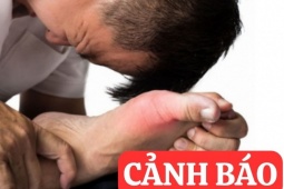 Tin tức sức khỏe - 6 thói quen tàn phá xương khớp cực nguy hiểm cần dừng lại ngay lập tức!
