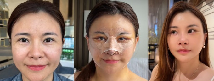 NSƯT Kim Oanh được khán giả khen trẻ ra 10-15 tuổi sau ca phẫu thuật thẩm mỹ tại Hàn Quốc hồi tháng 7.