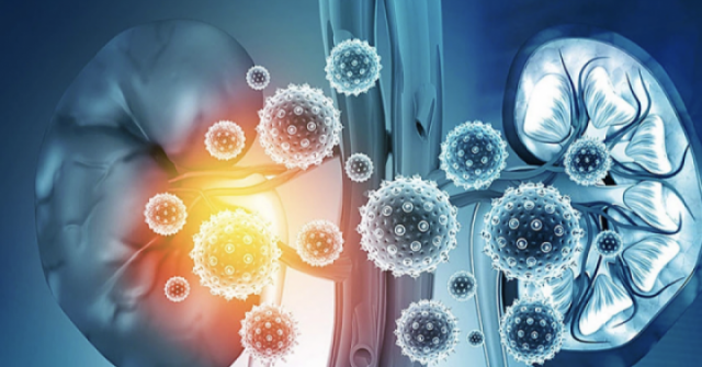 5 dấu hiệu trên mặt và cổ cảnh báo thận suy yếu