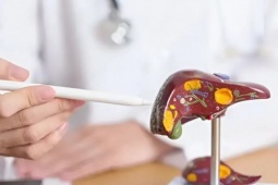 Sức khỏe đời sống - 6 thay đổi nhỏ đẩy lùi gan nhiễm mỡ trong 90 ngày