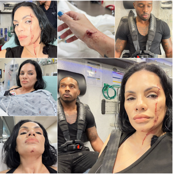 Cặp đôi được đưa đến bệnh viện với nhiều vết thương trên mặt và tay.