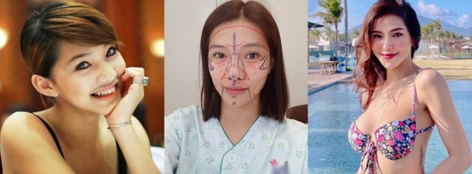 Trước đây, Lưu Đê Ly có phần cằm hơi bạnh, nhờ hàng loạt phương pháp, gương mặt của nữ diễn viên trông thon gọn, thanh thoát hơn theo thời gian.