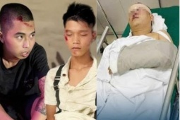 Tin tức trong ngày - Chiến sĩ CSCĐ bị 2 thanh niên 'thông chốt', tình trạng sức khỏe hiện ra sao?