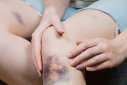 Sức khỏe đời sống - 9 thay đổi trên da cảnh báo bệnh gan, lupus ban đỏ hay tiểu đường