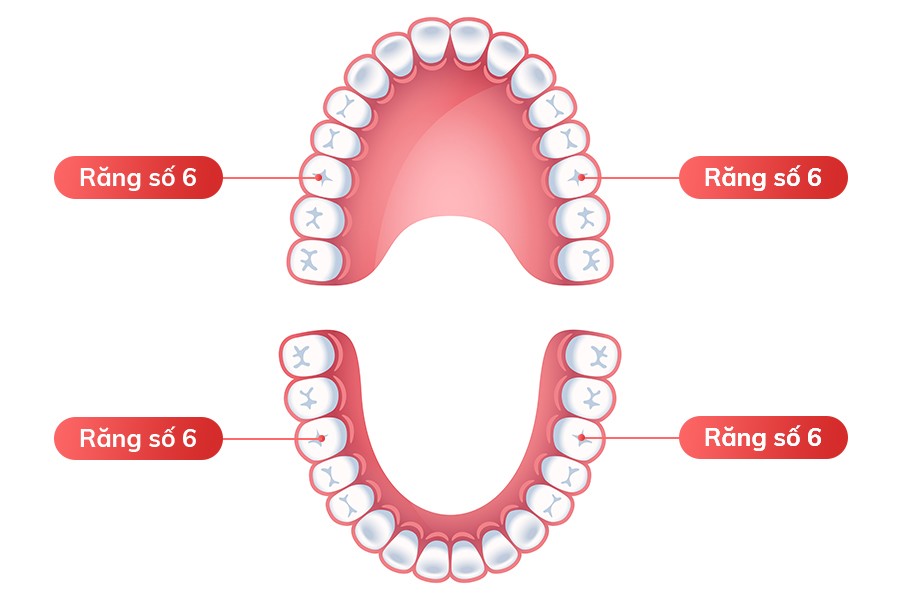 Răng số 6 là răng cối lớn và chỉ mọc một lần duy nhất