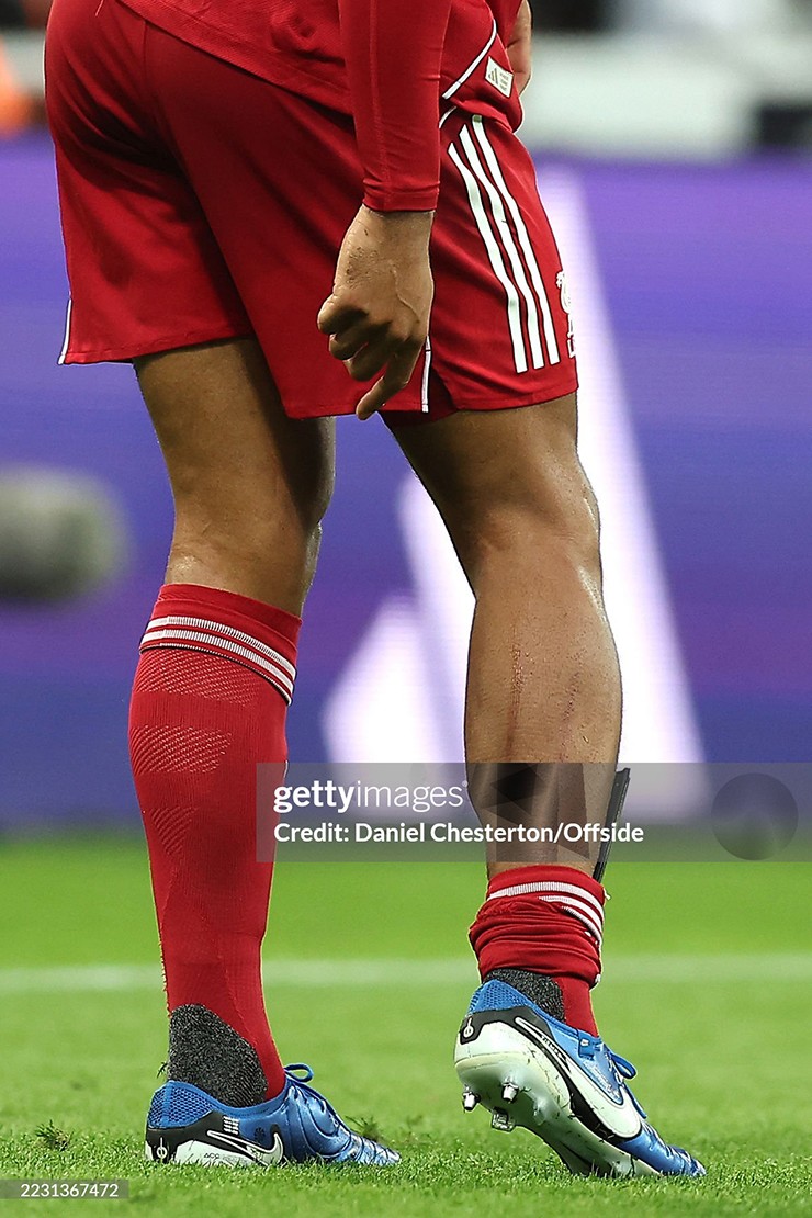 Vết thương ở bắp chân Virgil van Dijk sau pha vào bóng của Anthony Gordon