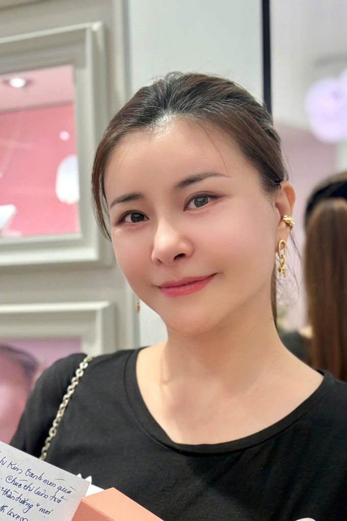 NSƯT Kim Oanh sau 1,5 tháng phẫu thuật thẩm mỹ.