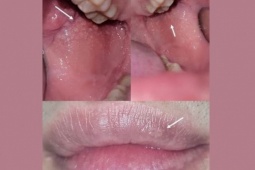 Cặp đôi lo sợ mắc bệnh tình dục sau quan hệ bằng miệng, bác sĩ chỉ ra sự thật