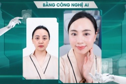 Trẻ hóa da AICollaBoost – Bí quyết giữ mãi làn da không tuổi