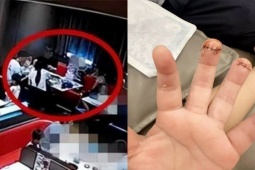 Thị trường - Tiêu dùng - Đi ăn quán, bé trai 2 tuổi bị tai nạn phải khâu sống, bố mẹ đòi bồi thường “khủng”