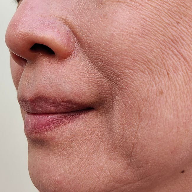 Lão hóa da là điều không thể tránh khỏi nhưng một số yếu tố liên quan đến lối sống có thể đẩy nhanh quá trình này, đặc biệt là những gì bạn đưa vào cơ thể.