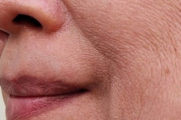 4 món ăn hàng ngày âm thầm khiến da cạn kiệt collagen