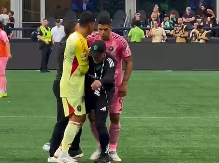 Suarez có hành động xấu xí