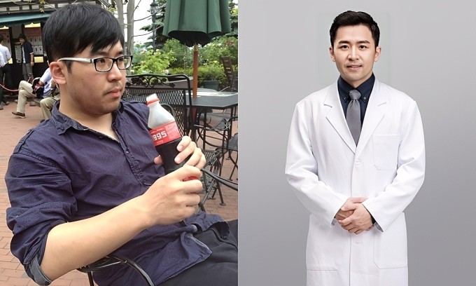 Bác sĩ Lỹ Đường Việt đã giảm 25 kg và duy trì cân nặng 10 năm không tăng lại. Ảnh: TVBS